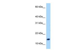 NPS Rabbit Polyclonal Antibody