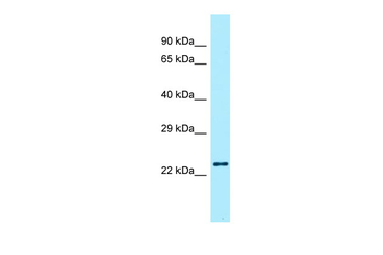 RLN2 Rabbit Polyclonal Antibody