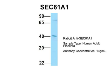 SEC61A1 Rabbit Polyclonal Antibody