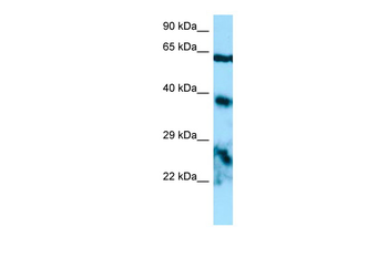 EPYC Rabbit Polyclonal Antibody