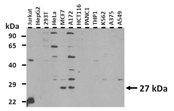 FTMT Rabbit Polyclonal Antibody