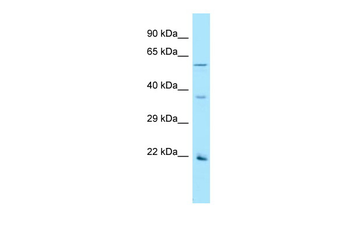 OR2AG1 Rabbit Polyclonal Antibody