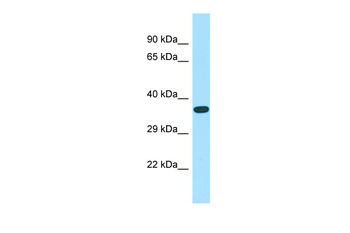 ASB14 Rabbit Polyclonal Antibody