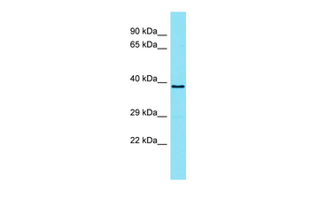 TMEM121 Rabbit Polyclonal Antibody