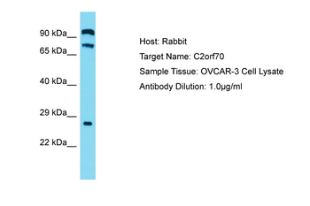 C2orf70 Rabbit Polyclonal Antibody
