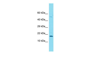 FOXL2NB Rabbit Polyclonal Antibody