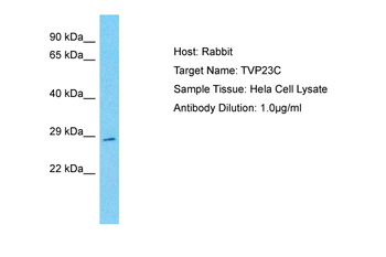 TVP23C Rabbit Polyclonal Antibody