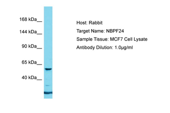 NBPF24 Rabbit Polyclonal Antibody