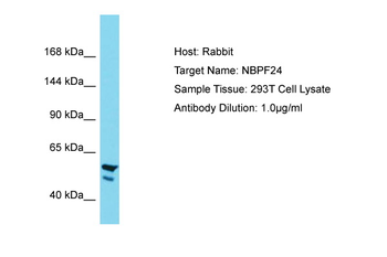 NBPF24 Rabbit Polyclonal Antibody