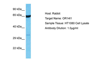 OR14I1 Rabbit Polyclonal Antibody