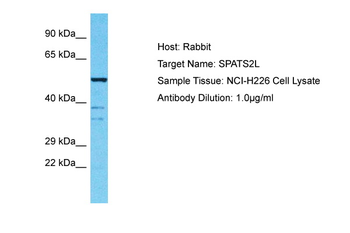 SPATS2L Rabbit Polyclonal Antibody