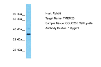 TMEM26 Rabbit Polyclonal Antibody