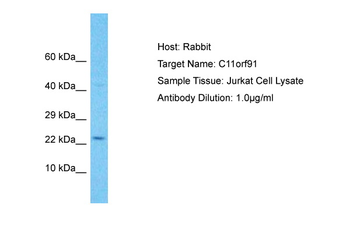 C11orf91 Rabbit Polyclonal Antibody