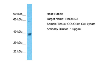 TMEM236 Rabbit Polyclonal Antibody