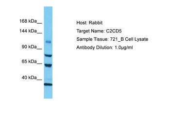 C2CD5 Rabbit Polyclonal Antibody