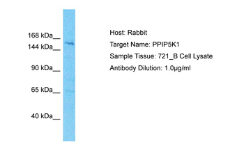 PPIP5K1 Rabbit Polyclonal Antibody