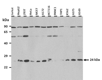 DCAF16 Rabbit Polyclonal Antibody