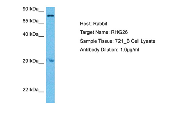 ARHGAP26 Rabbit Polyclonal Antibody