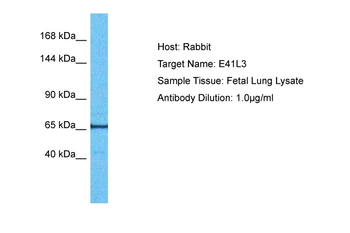 EPB41L3 Rabbit Polyclonal Antibody