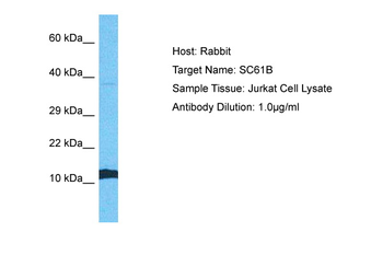 SEC61B Rabbit Polyclonal Antibody