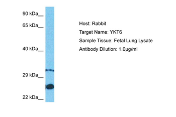 YKT6 Rabbit Polyclonal Antibody