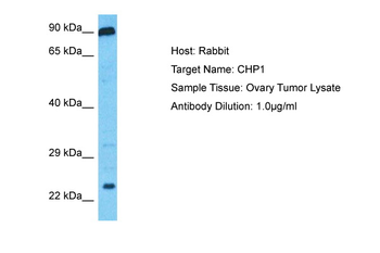 CHP1 Rabbit Polyclonal Antibody