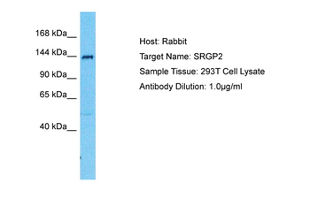 SRGAP2 Rabbit Polyclonal Antibody