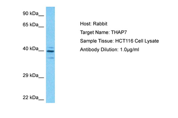 THAP7 Rabbit Polyclonal Antibody