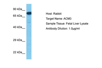 CHRM3 Rabbit Polyclonal Antibody