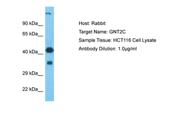 GCNT2 Rabbit Polyclonal Antibody