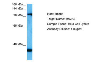 MAN2A2 Rabbit Polyclonal Antibody
