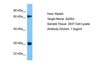 SLC20A2 Rabbit Polyclonal Antibody