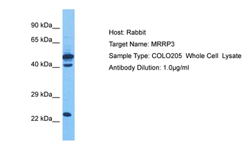 KIAA0391 Rabbit Polyclonal Antibody