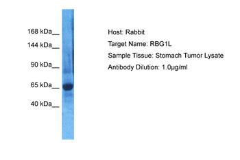 RABGAP1L Rabbit Polyclonal Antibody