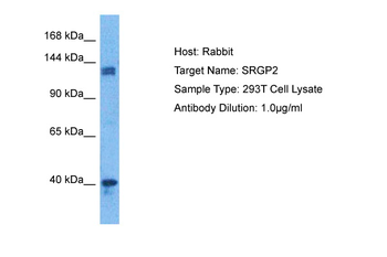 SRGAP2 Rabbit Polyclonal Antibody