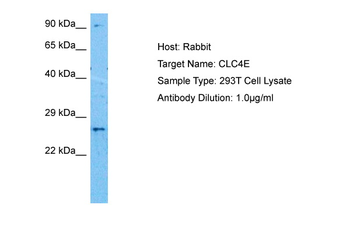 CLEC4E Rabbit Polyclonal Antibody