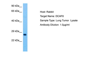 DCAF8 Rabbit Polyclonal Antibody