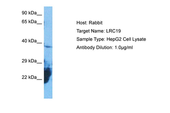 LRRC19 Rabbit Polyclonal Antibody