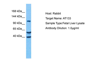 ATP13A3 Rabbit Polyclonal Antibody