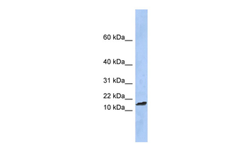 TAL2 Rabbit Polyclonal Antibody
