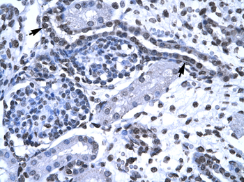 FOXG1A Rabbit Polyclonal Antibody