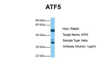 ATF5 Rabbit Polyclonal Antibody