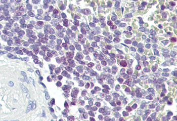 ELF1 Rabbit Polyclonal Antibody