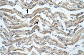 MSX1 Rabbit Polyclonal Antibody