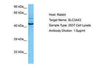 SLC34A3 Rabbit Polyclonal Antibody