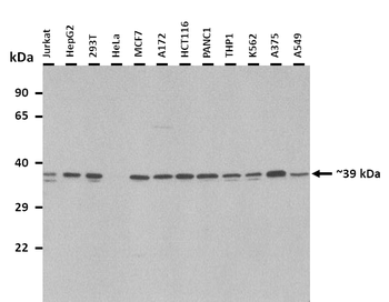 WNT4 Rabbit Polyclonal Antibody