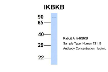 IKBKB Rabbit Polyclonal Antibody