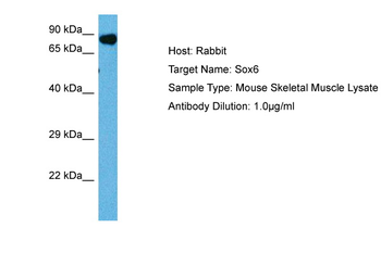 SOX6 Rabbit Polyclonal Antibody