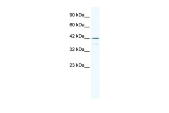 SOX3 Rabbit Polyclonal Antibody