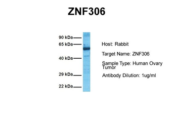 ZNF306 Rabbit Polyclonal Antibody